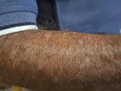 arm 