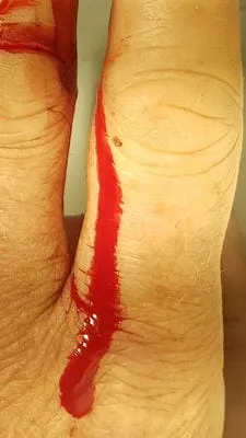 blood 