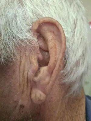 ear 